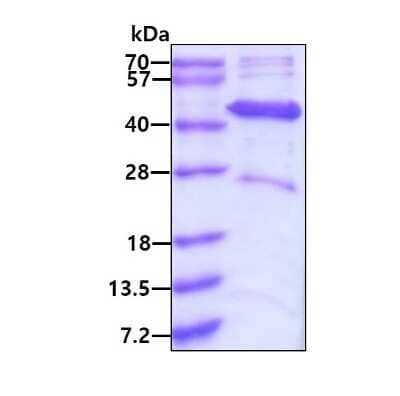 SDS-Page: Recombinant Human ACADL His Protein [NBP1-72517] - 3ug by SDS-PAGE under reducing condition and visualized by coomassie blue stain.